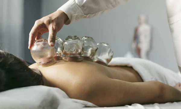 Dry Needling And Cupping